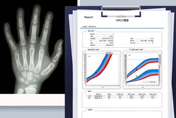 성장검사 안내01