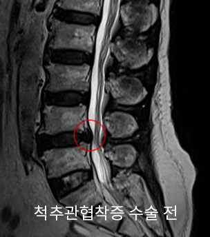 수술 전