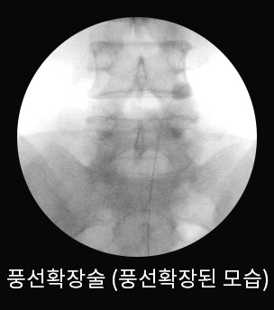 수술 전