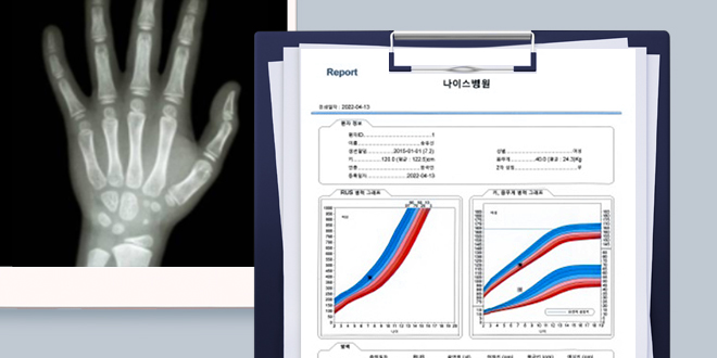 성장판 검사